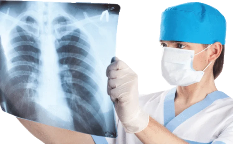 rib-x-ray
